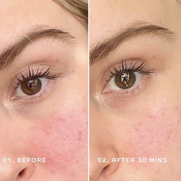 Ren Clean Skincare - Evercalm - Redness Relief Serum - NEW - Picture 3 of 7